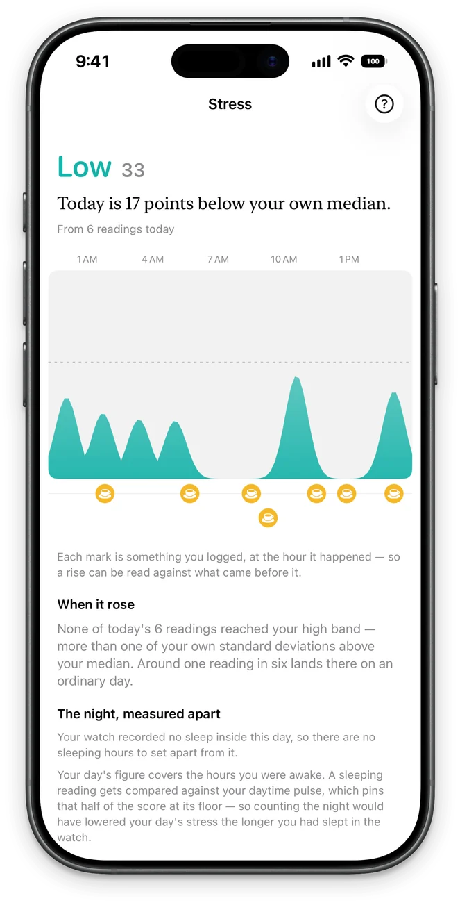 Stress screen: the day reading by reading along the clock, with marks for what you logged and the night measured apart.