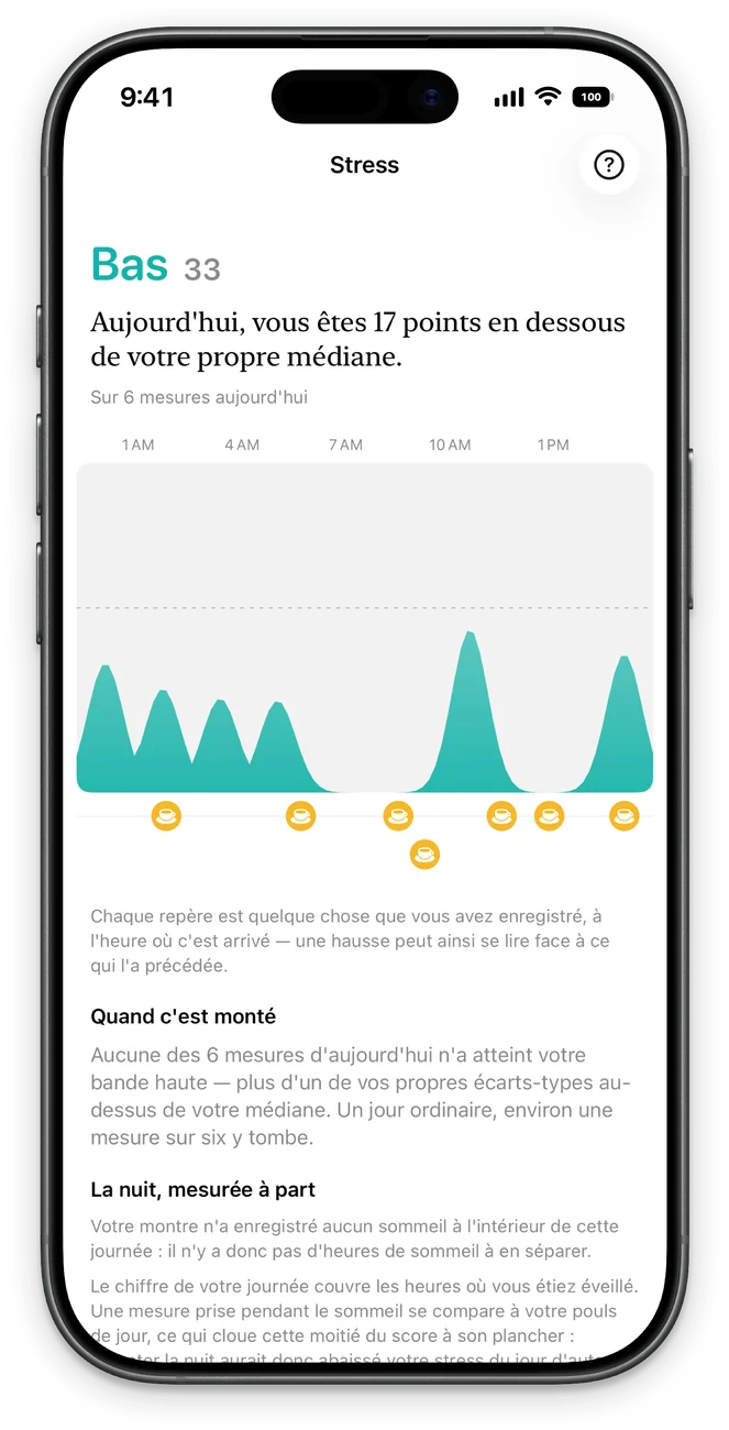 Écran de stress : la journée mesure par mesure le long de l’horloge, avec les repères de ce que vous avez noté et la nuit mesurée à part.